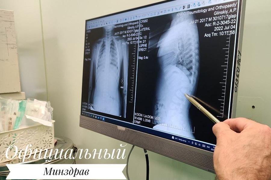 Снимок позвоночника после операции
