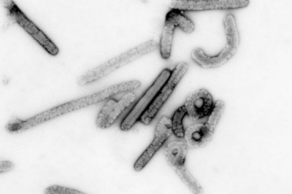 Вирус Марбург под электронным микроскопом