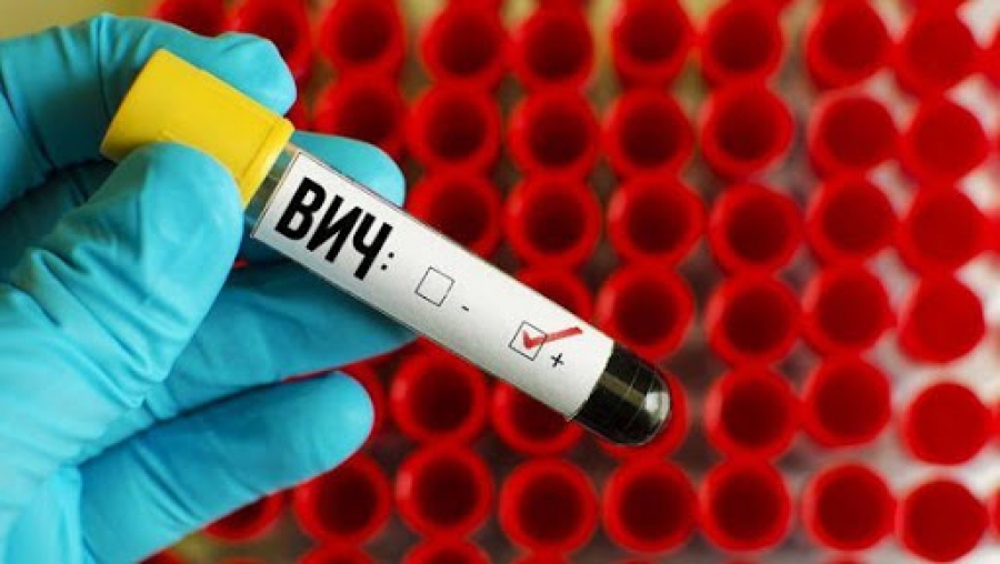 Показатель заболеваемости ВИЧ в Минской области снизился на 17 процентов