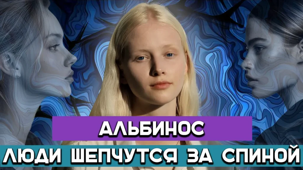 Жизнь вне стандартов: 20-летняя девушка с альбинизмом о себе и мире