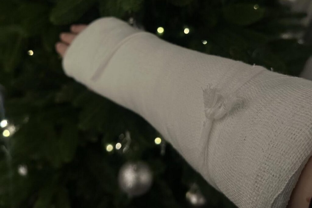 Девушка сломала руку в одном из магазинов Гомеля — ответ администрации на случившееся удивил сеть