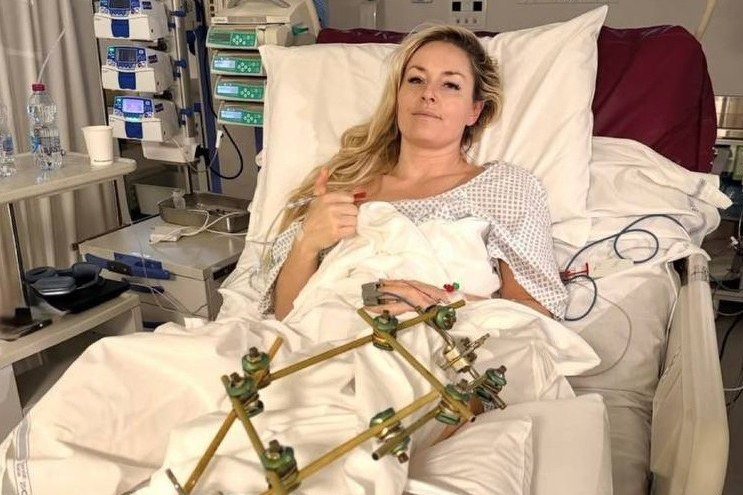 Американская горнолыжница Линдси Вонн перенесла третью операцию после падения на Олимпиаде