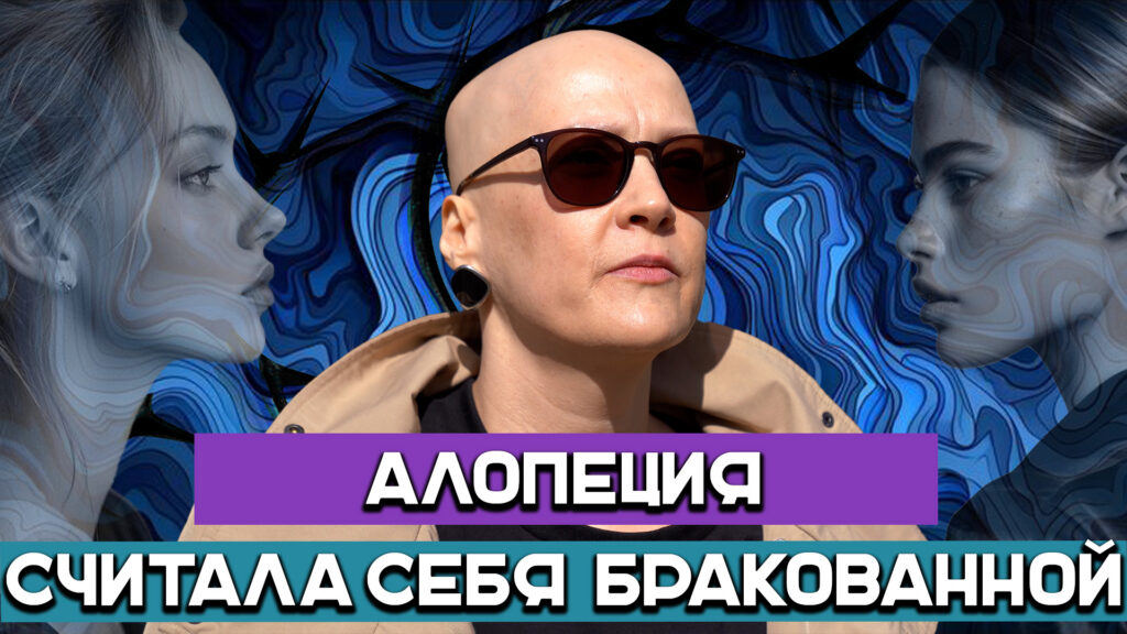 43 года без волос: как женщина с алопецией перестала прятаться и начала новую жизнь