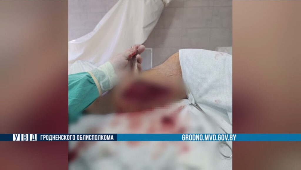 60-летний житель Гродненщины получил огнестрельные ранения в Польше: мужчина в тяжёлом состоянии